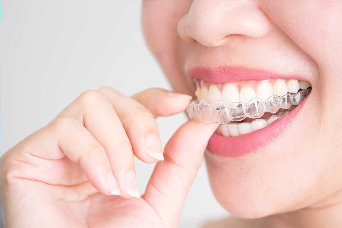 Denticop